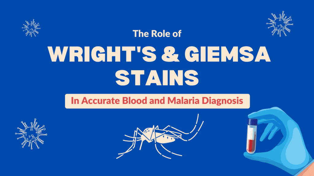 wrights and giemsa stains for accurate diagnosis